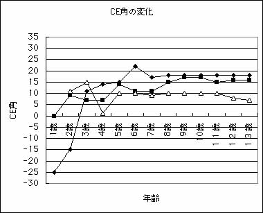 CE角の変化