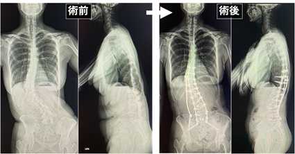 症例
