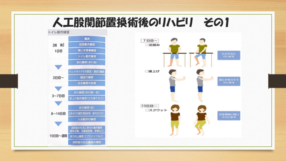 人工股関節置換術後のリハビリを示す画像です。
