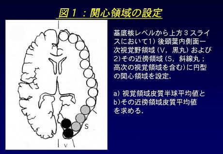 関心領域の設定